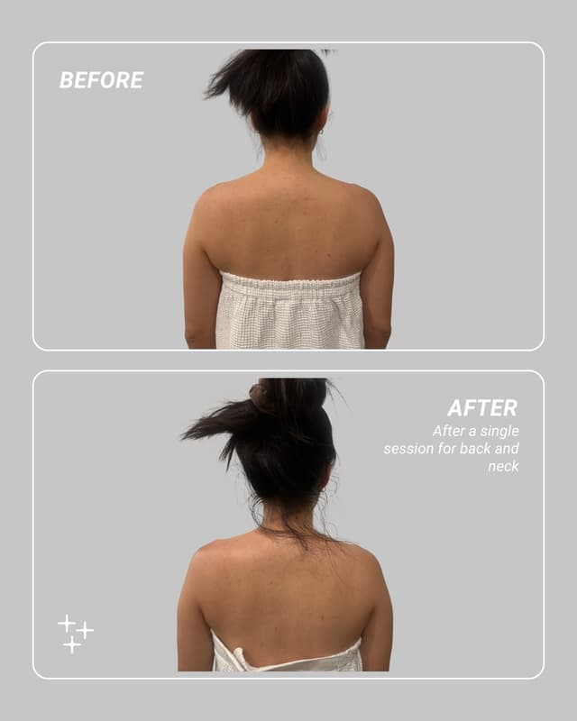 Before and after a single energy therapy session for back and neck — shoulders visibly more open